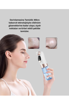 Titreşimli Elektrikli Gözenek Açıcı – Siyah Nokta ve Yağ Arındırıcı Titreşimli Elektrikli Gözenek Açıcı – Siyah Nokta ve Yağ Arındırıcı