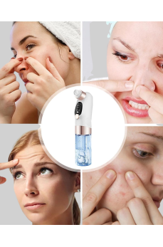 Çok Fonksiyonlu Cilt Bakım Cihazı – Siyah Nokta, Gözenek ve Akne Temizleyici