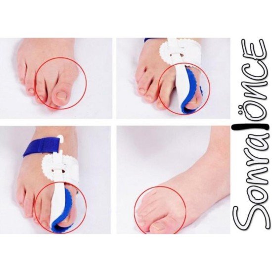 Baş Parmak Kemik Düzeltici Gece Ateli (Çift) Baş Parmak Kemik Düzeltici Gece Ateli (Çift)