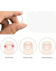 BAŞ PARMAK TIRNAK BATMASINI ENGELLEYEN METAL APARAT NRD 603 ***