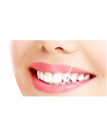 Diş Kristali ve Diş Pırlantası Komple Set - Muhteşem Gülüş Seti