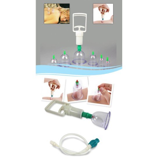 Hacamat Seti Hortumlu - Vakumlu Hortumlu Kupa Çekme Seti 14 Parça Hacamat Seti Hortumlu - Vakumlu Hortumlu Kupa Çekme Seti 14 Parça