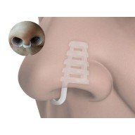 Horlama Burun Aparatı - Kafesli Horlama Burun Aparatı - Kafesli