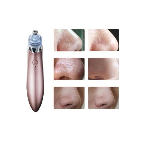 SİYAH NOKTA CİHAZI SİYAH NOKTA CİHAZI