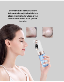 Professional Blackhead Remover with Adjustable Suction Power
