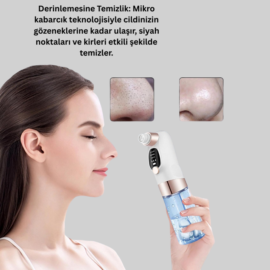 Professional Blackhead Remover with Adjustable Suction Power
