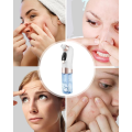 Professional Blackhead Remover with Adjustable Suction Power
