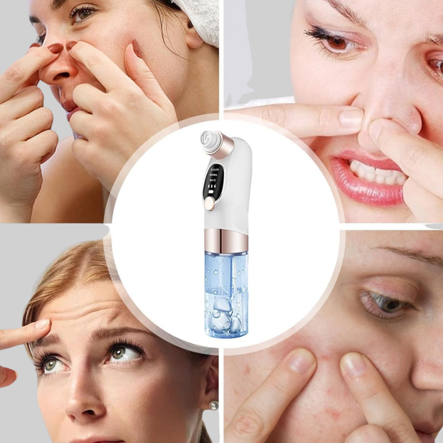 Professional Blackhead Remover with Adjustable Suction Power