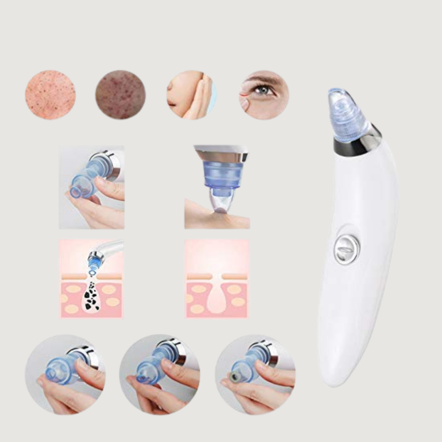 Powerful Vacuum Blackhead Cleaner – Removes Skin Impurities Powerful Vacuum Blackhead Cleaner – Removes Skin Impurities