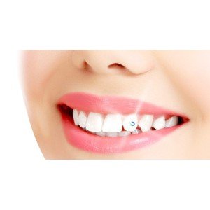 Dental Crystal and Dental Diamond Complete Set - Magnificent Smile Set
