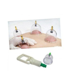Cupping Set - Vacuum Cupping Set (Model 1)
