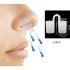 Nasal Appliance to Help Prevent Snoring