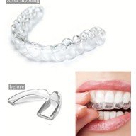 515 Bruxism Night Apparatus (Night Plate)