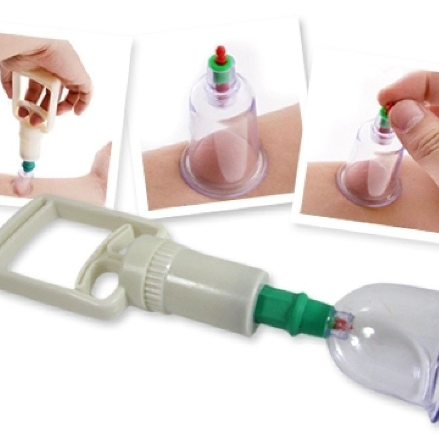 Vacuum Cup Pull Set (6 Pieces)