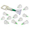 Vacuum Cup Pull Set (12 Pieces)