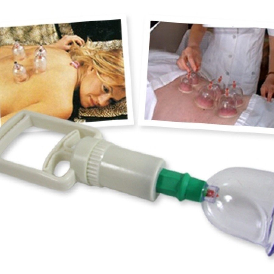 Vacuum Cup Pull Set (12 Pieces)
